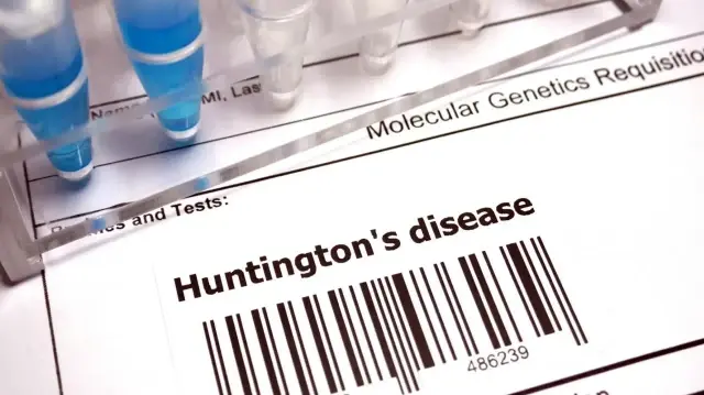 huntington hastaliginda tarihi gelisme yeni tedavi yuzde 75 yavaslatiyor 4hWNPXZj